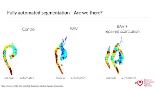 Webinar 25 Machine Learning in cardiovascular imaging by Tim Leiner