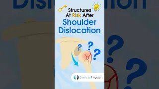 Structures at Risk After Shoulder Dislocation #physicaltherapy #physiotherapy #shoulder