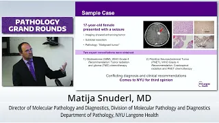 Molecular Diagnostics and Machine Learning for Diagnostics and Therapeutic Discovery in Brain Tumors