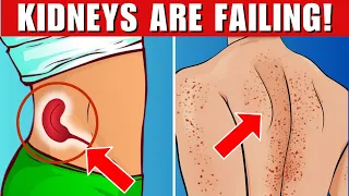 10  Signs Your Kidneys Are Crying For Help!