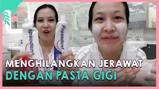 Menghilangkan Jerawat Dengan Pasta Gigi, Benarkah Ampuh?