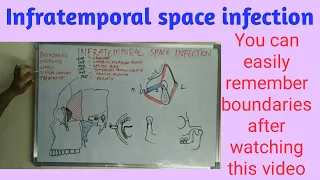 Infratemporal space infection