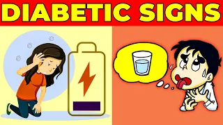 7 ALARMING Signs of High Blood Sugar | Diabetic Symptoms