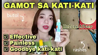 MABISANG GAMOT SA KATI KATI NG BALAT o KATAWAN | Rashes Pantal Butol Buni Insect bites & Skinallergy