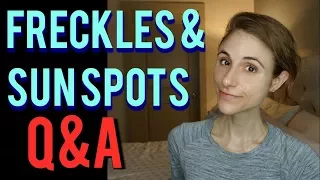 Freckles, Age Spots, Sun spots: Q&A with a dermatologist 🙂🌞🤔