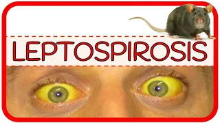 LEPTOSPIROSIS – fisiopatología, microbiología, signos y síntomas, diagnóstico y tratamiento