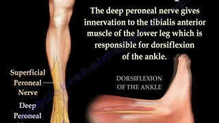 Foot Drop, Peroneal Nerve Injury - Everything You Need To Know - Dr. Nabil Ebraheim