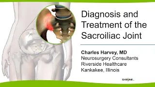 Diagnosis and Treatment of the Sacroiliac Joint - Charles Harvey, MD