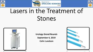 Lasers in the treatment of stones