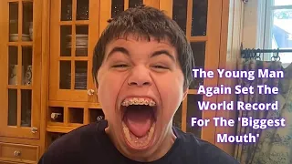 The Young Man Again Set The World Record For The Biggest Mouth | Issac Johnson Video | Issac Johnson