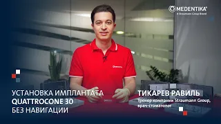 Установка имплантата Medentika Quattrocone без навигации