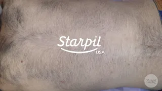 How to Wax Men's Back Hair - Full Back Hair Removal - Starpil Wax