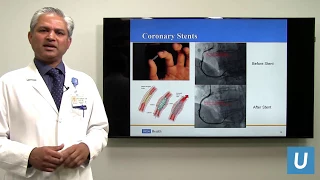 Coronary Angiography and Stent Interventions | Ravi Dave, MD | UCLAMDChat