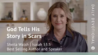 God Tells His Story in Scars | Isaiah 53:5 | Our Daily Bread Video Devotional