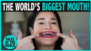 The World’s Largest Mouth (4 inches!)