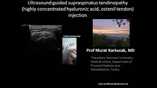 Ultrasound guided supraspinatus tendinopathy ( hyaluronic acid, ostenil tendon) injection