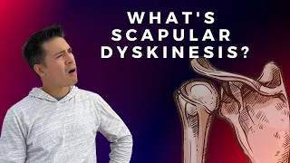 Scapular Dyskinesis and Shoulder Pain