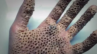 Trypophobia Test - Do you have a fear of small holes?