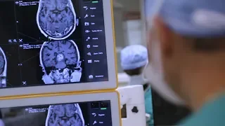 New SCUBA Procedure for Intracerebral Hemorrhage Stroke Patients