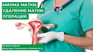 Миома матки. Удаление матки, операция. Комментарии акушера-гинеколога Майер М.А.