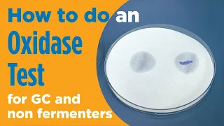 How to perform an Oxidase test in microbiology for gonorrhea and non fermenters