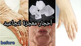 كنز ربانى عظيم سبحان الله سيخلصك من تجاعيد  الوجه واليدين سيجعل بشرتك  مشدودة أقوى بوطوكس طبيعى