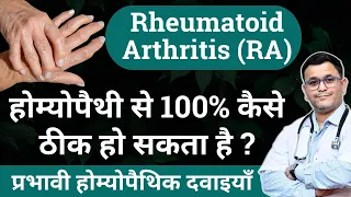 Rheumatoid Arthritis Homeopathy treatment homeopathic medicine for rheumatoid arthritis #RxHpathy