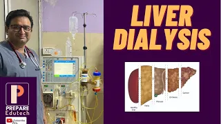 Liver Dialysis| DPMAS| MARS| PrepEd app for Nursing and Paramedical students