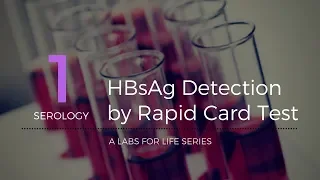 HBsAg Detection by Rapid Card Test