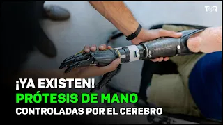 ¡Ya existen! Prótesis de mano controladas por el cerebro