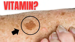 No. 1 VITAMIN for removing AGE SKIN SPOTS!