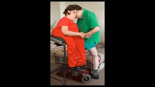 Oldest living conjoined twins, Lori and George Schappell, die at 62