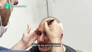 Michael Hiza Ateaga - Bolivian Hair Transplant Patient