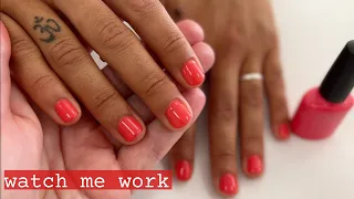 Growing out bitten nails and acrylic damage (PART 3) [Watch Me Work]