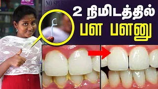 Teeth Care: இத செஞ்சா உங்க பல் நட்சத்திரமா மின்னும்💥| How to avoid bad breath | Dentist Advice