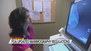 Mammogram facilities must notify women if they have dense breast tissue, FDA new guidances say