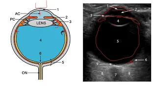 Lecture 1:- Technique of Ocular POCUS