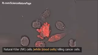 Natural Killer cells killing cancer