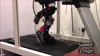 First steps on the Gen2 UTDallas robotic prosthetic leg