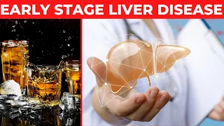 How Much Alcohol Would You Have to Drink Before Liver Damage | How much Alcohol will damage Liver?