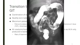 Y4C 2016 Revision Lecture #1 -  Neonatology by Edward Cliff