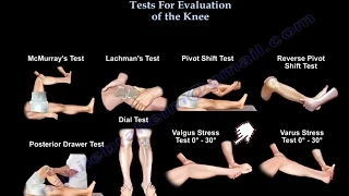 Tests For  Examination  Of The Knee - Everything You Need To Know - Dr. Nabil Ebraheim