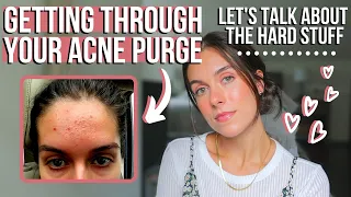 GETTING THROUGH YOUR TRETINOIN PURGE - TIPS FOR YOUR MENTAL HEALTH AND SKIN | Rudi Berry