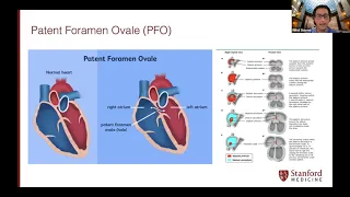 Structural Interventions in Cardiology | Stanford Department of Medicine Grand Rounds | 23 June 2021