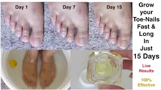 Grow your Toe-Nails fast and long in just 15 days || Faster Nail Growth || Mamtha Nair