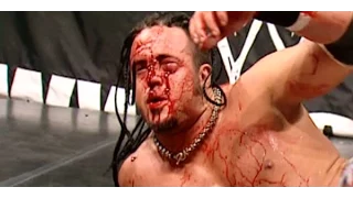 10 Worst Botches In WWE History