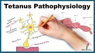 Tetanus Pathophysiology (Mechanism of Action)