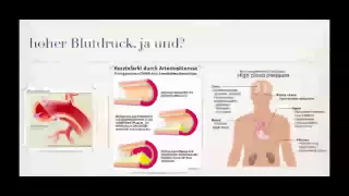 hoher Blutdruck - Bluthochdruck - arterielle Hypertonie