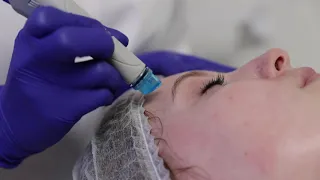 Вакуумна Чистка Обличчя (Hydrafacial) у Львові