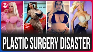 20 Disastrous Cosmetic Surgeries | You'll Never Realize